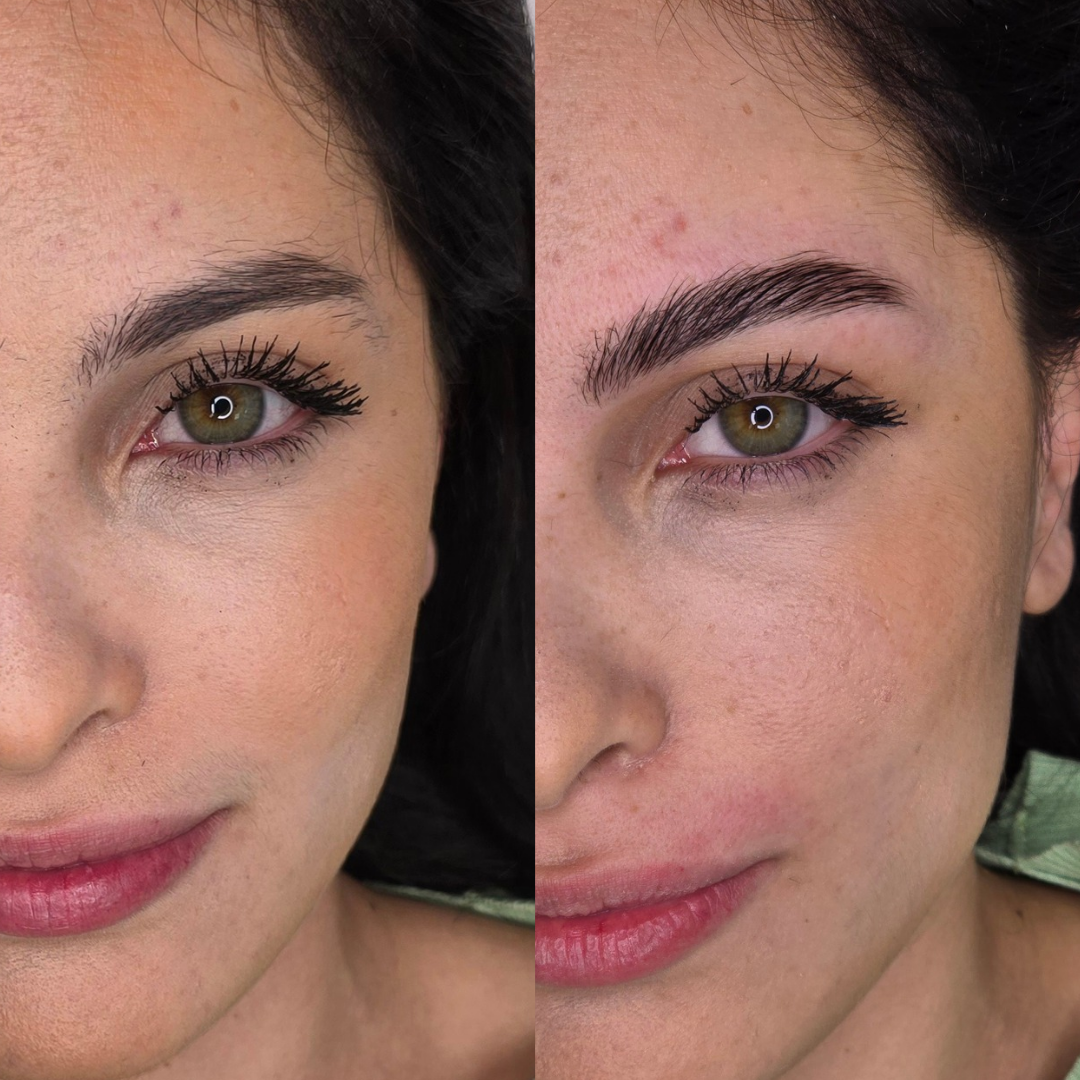 Antes y Después - Laminado de Cejas